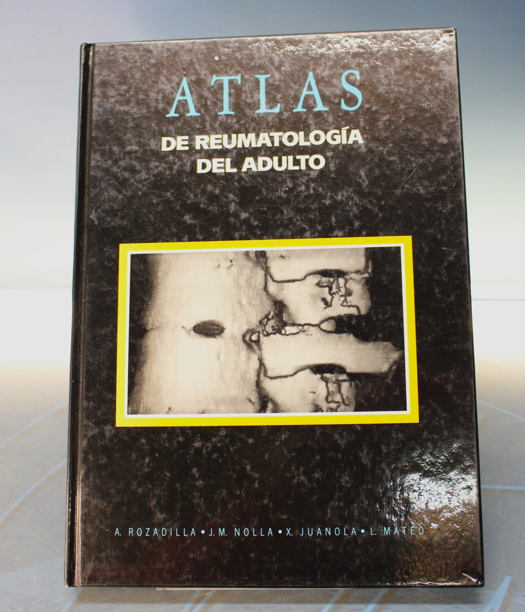 IMG_1143 Atlas de Reumatología del Adulto. Laboratorios Almirall S.A., 1993. - Imagen 1